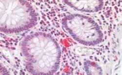 HOXA10 Antibody, Novus Biologicals 50 &mu;g | Buy Online | Novus Biologicals | Fisher Scientific